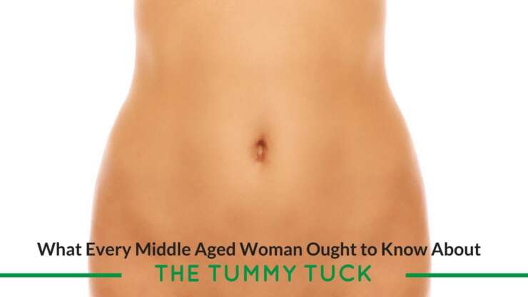 What Every Middle-Aged Woman Ought to Know About the Tummy Tuck