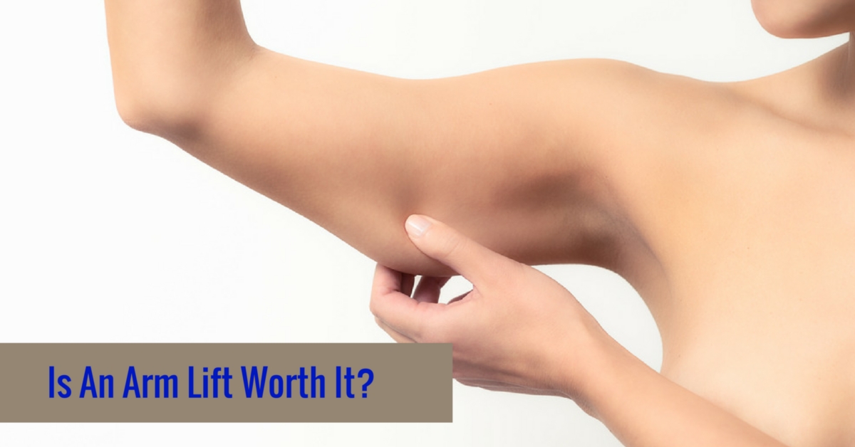 Is An Arm Lift Worth It?