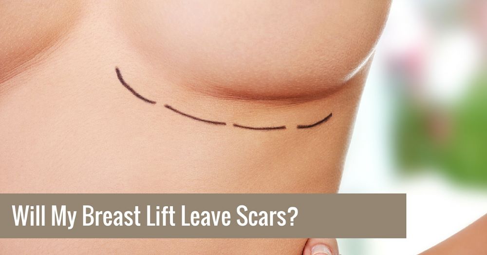 Breast Lift Scars: What to Expect