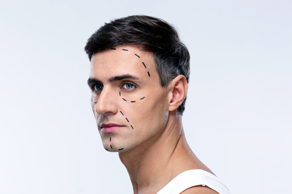 Why More Men are Opting for Cosmetic Surgery