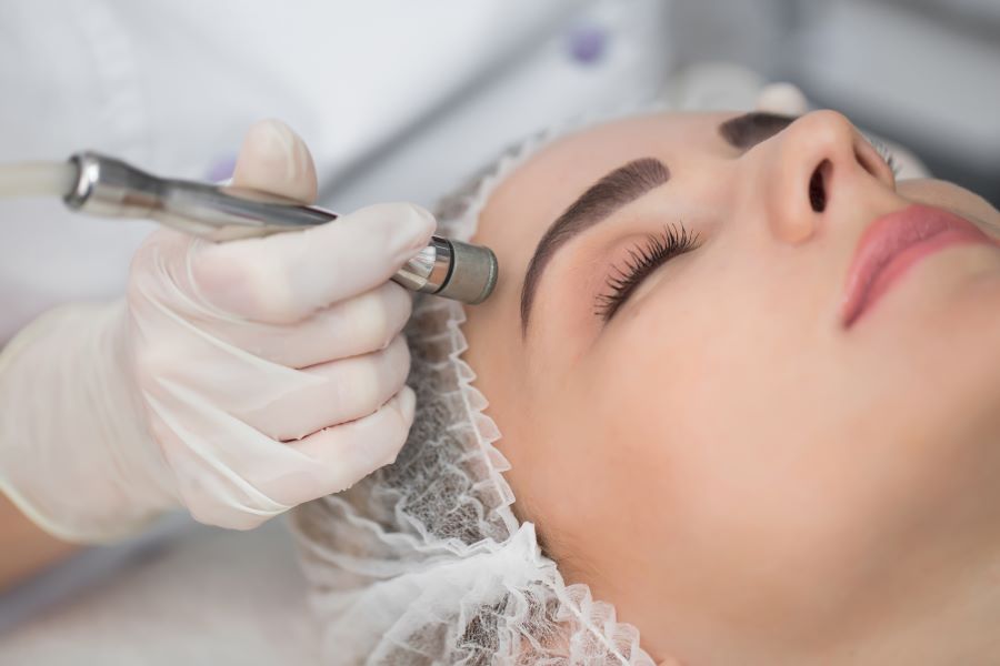 Microdermabrasion cosmetic treatment in Barrie, Ontario