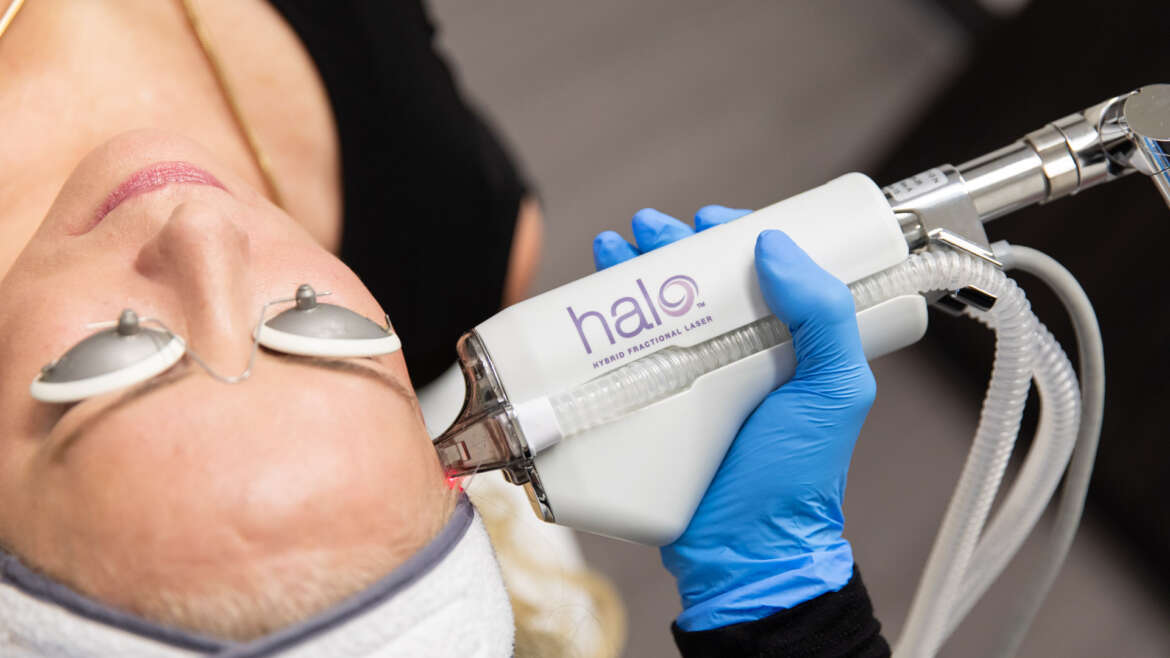 Halo Laser Treatment: What is It and How Much Does it Cost?